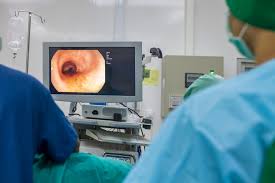 الخوف والخجل من منظار القولون: كيف تغلّب الطب الحديث على هذه العقبات؟